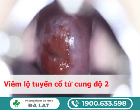 Block Image